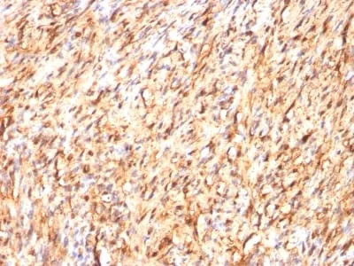 Anti-S100B(S100B/1012), CF640R conjugate - image 2