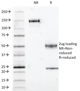 Anti-S100B(S100B/1012), CF640R conjugate - image 5