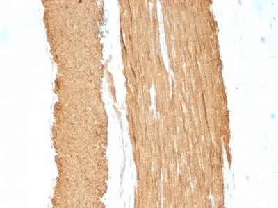 Anti-Smooth Muscle Actin(ACTA2/791 +1A4) - image 2