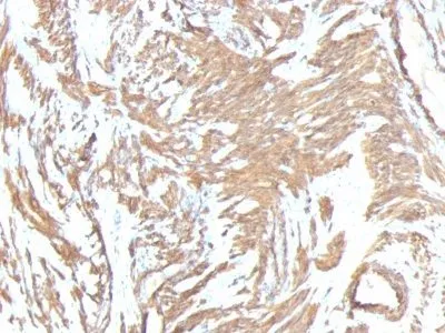 Anti-Smooth Muscle Actin(ACTA2/791 +1A4) - image 3