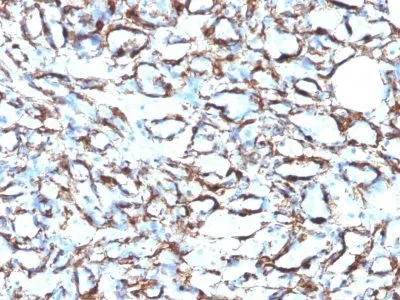 Anti-Smooth Muscle Actin(ACTA2/791 +1A4) - image 4