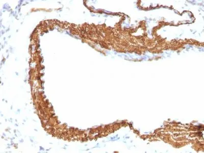 Anti-Smooth Muscle Actin(ACTA2/791 +1A4) - image 1