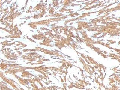 Anti-Smooth Muscle Actin(ACTA2/791) - image 2