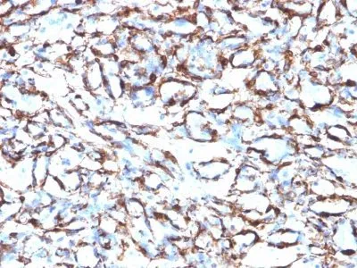Anti-Smooth Muscle Actin(ACTA2/791) - image 1