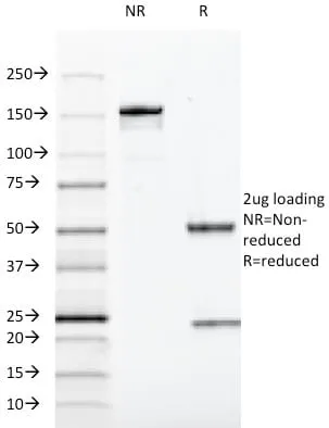 Anti-SOX10(SOX10/991), CF640R conjugate - image 4
