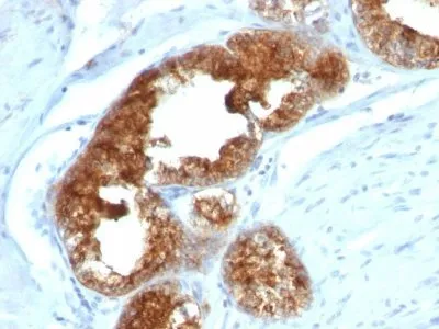 Anti-TAG-72 / CA72.4(B72.3 + CA72/733), CF594 conjugate - image 1