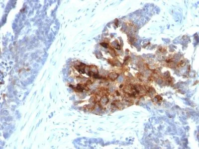 Anti-TAG-72 / CA72.4(B72.3 + CA72/733), CF640R conjugate - image 2