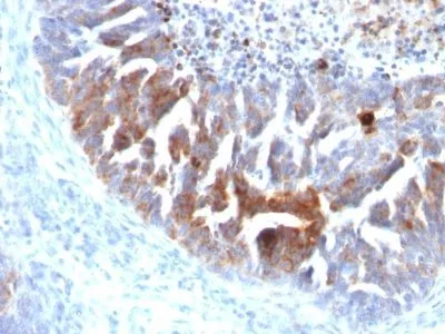 Anti-TAG-72 / CA72.4(B72.3 + CC49), CF640R conjugate - image 2