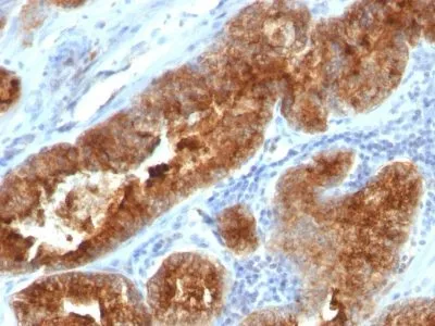 Anti-TAG-72 / CA72.4(B72.3 + CC49), CF640R conjugate - image 1