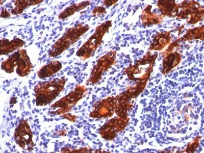 Anti-Thyroglobulin(2H11) - image 1