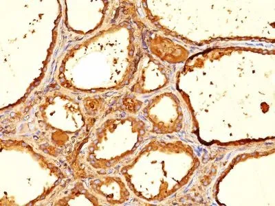 Anti-Thyroglobulin(6E1.), Biotin conjugate - image 1
