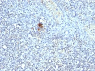 Anti-TRAcP (Tartarate Resistant Acid Phosphatase)(ACP5/1070), CF594 conjugate - image 1