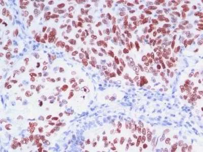 Anti-TTF-1 / NKX2.1(8G7G3/1 + NX2.1/690), CF568 conjugate - image 1