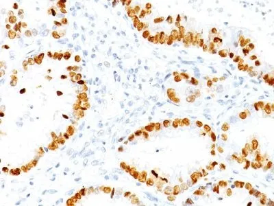 Anti-TTF-1 / NKX2.1(NX2.1/690), CF594 conjugate - image 1