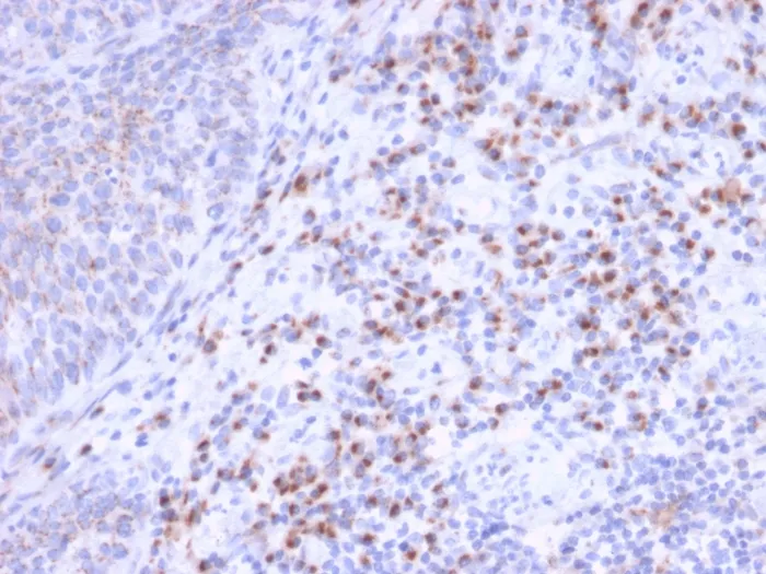 Anti-RCAS1 / Estrogen Receptor Binding Site Associated, Antigen 9(CPTC-EBAG9-1), CF740 conjugate - image 1