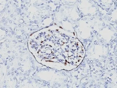 Anti-WT1 (Wilm's Tumor 1)(6F-H2), CF640R conjugate - image 1