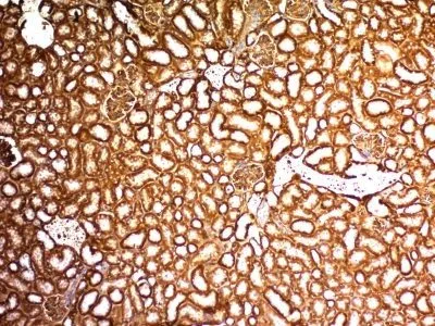 Anti-WT1 (Wilm's Tumor 1)(WT1/857) - image 2