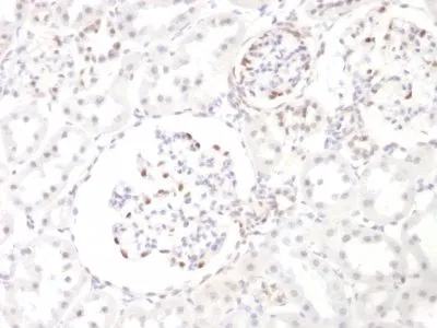 Anti-WT1 (Wilm's Tumor 1)(WT1/857) - image 3