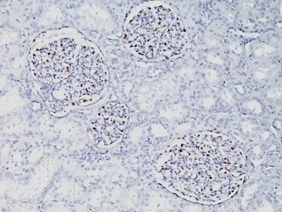 Anti-WT1 (Wilm's Tumor 1)(WT1/857) - image 1