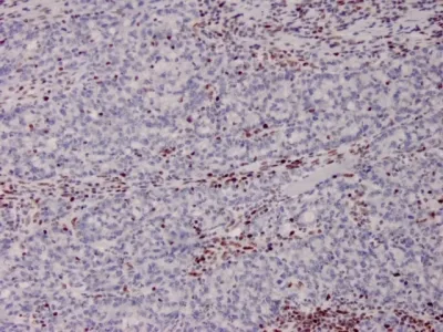 Anti-MSH2 (DNA Mismatch Repair Marker)(MSH2/2622), CF740 conjugate - image 1