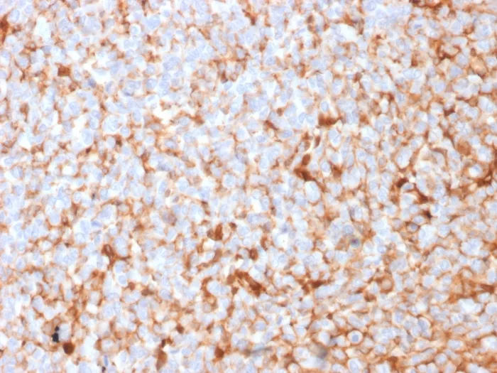 Anti-Mammaglobin (SCGB2A2) (Breast Cancer Marker)(MGB1/2682R), CF740 conjugate - image 1