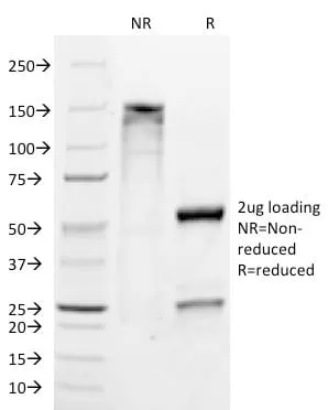 Anti-ETS1 / (Marker of Tumor Metastasis) (ETS1/1282), CF640R conjugate - image 2