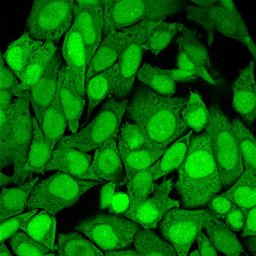 Anti-S100A4 (Marker of Tumor Metastasis) (S100A4/1482), CF647 conjugate - image 1