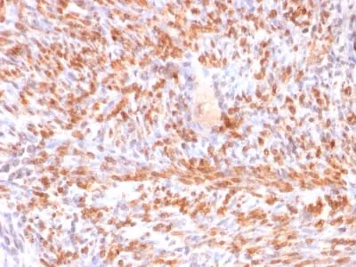 Anti-Calponin-1 (Smooth Muscle Marker) (rCNN1/832), CF640R conjugate - image 1