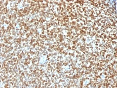 Anti-NKX2.2 (Neuroendocrine & Ewing s Sarcoma Marker) (NX2/1422R), CF568 conjugate - image 1
