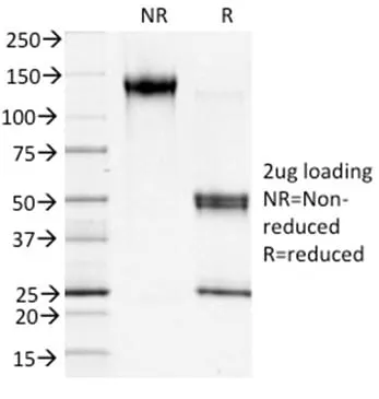 Anti-S100A4 (Marker of Tumor Metastasis) (S100A4/1481), CF568 conjugate - image 3