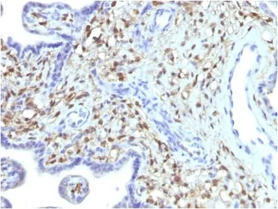 Anti-S100A4 (Marker of Tumor Metastasis) (S100A4/1481), CF568 conjugate - image 1