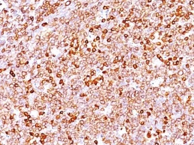 Anti-CD79a (IGA/1688R), CF488A conjugate - image 1