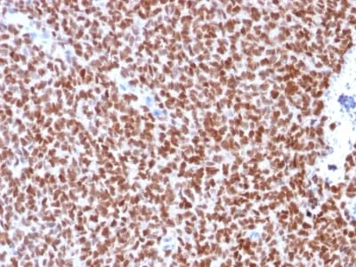 Anti-NKX2.2 (Neuroendocrine & Ewing s Sarcoma Marker) (rNX2/294), CF594 conjugate - image 1