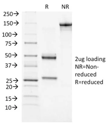 Anti-BRCA1 (Breast Marker) (BRCA1/1472), Biotin conjugate - image 1