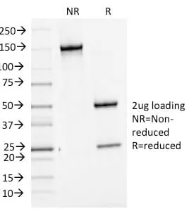 Anti-Bcl-6 (Follicular Lymphoma Marker) (BCL6/1475), Biotin conjugate - image 2