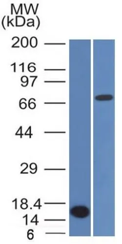 Anti-Bcl-6 (Follicular Lymphoma Marker) (BCL6/1475), Biotin conjugate - image 1