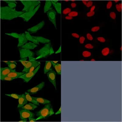 Anti-S100A4 (Marker of Tumor Metastasis) (S100A4/1481), Biotin conjugate - image 5