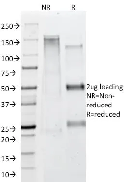 Anti-Adipophilin / Perilipin-2 (Marker of Obesity) (ADFP/1365) - image 3