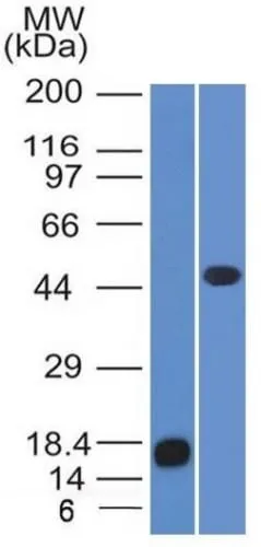 Anti-Adipophilin / Perilipin-2 (Marker of Obesity) (ADFP/1365) - image 1