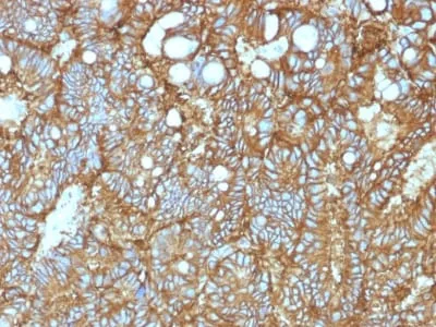 Anti-Ep-CAM / CD326 (Extracellular Domain) (Epithelial Marker) (EGP40/1372) - image 4