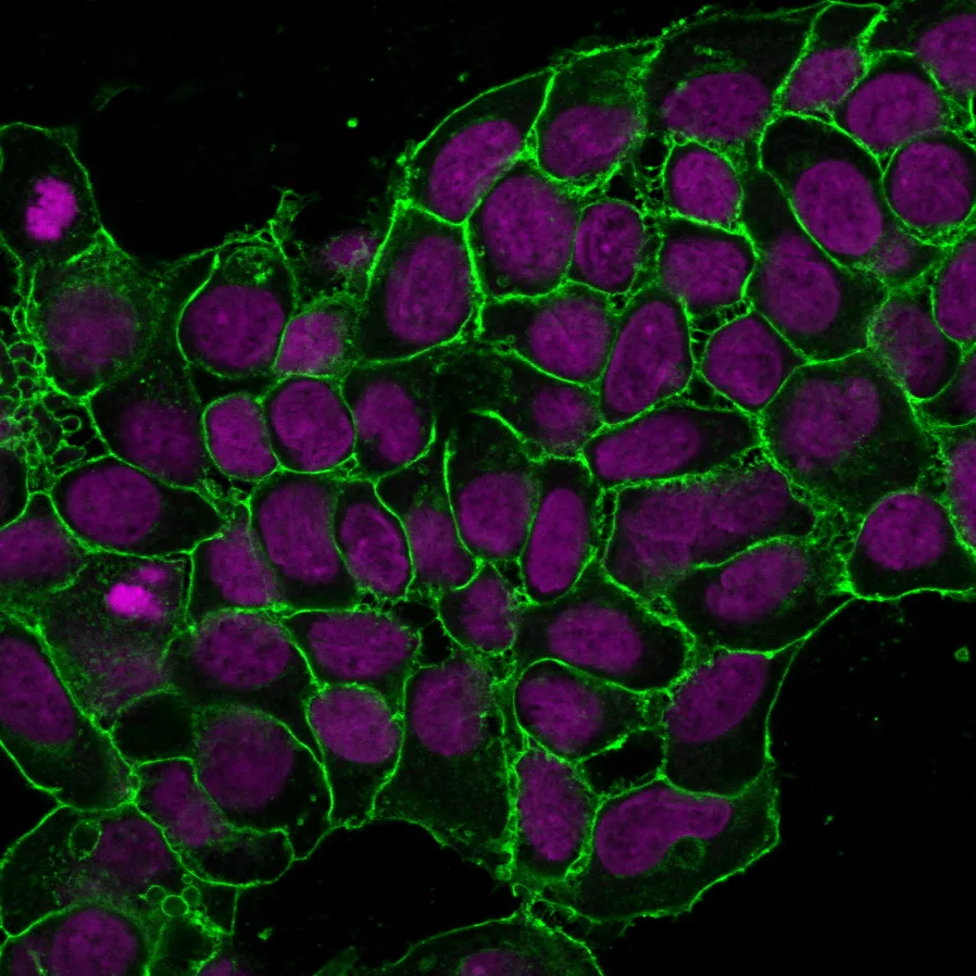 Anti-Ep-CAM / CD326 (Extracellular Domain) (Epithelial Marker) (EGP40/1372) - image 2
