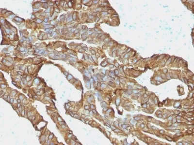Anti-Ep-CAM / CD326 (Extracellular Domain) (Epithelial Marker) (EGP40/1372) - image 5