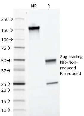 Anti-Ep-CAM / CD326 (Extracellular Domain) (Epithelial Marker) (EGP40/1372) - image 8