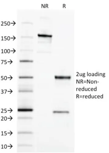 Anti-Ep-CAM / CD326 (Extracellular Domain) (Epithelial Marker) (EGP40/1373) - image 2