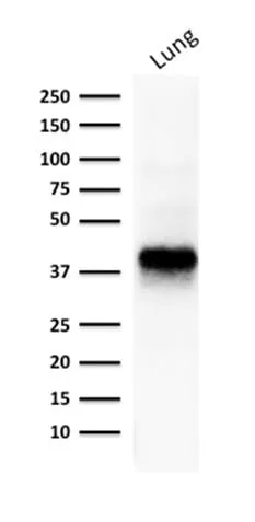 Anti-Ep-CAM / CD326 (Extracellular Domain) (Epithelial Marker) (EGP40/1373) - image 3