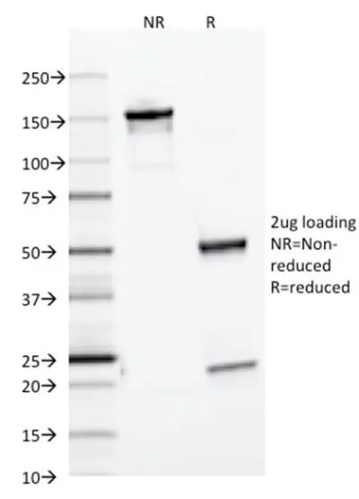 Anti-Ferritin, Light Chain (FTL) (Microglia Marker) (FTL/1386) - image 3