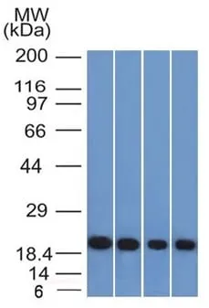 Anti-Ferritin, Light Chain (FTL) (Microglia Marker) (FTL/1386) - image 1