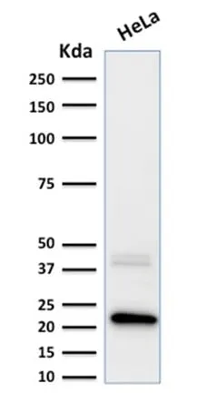 Anti-Ferritin, Light Chain (FTL) (Microglia Marker) (FTL/1389) - image 3