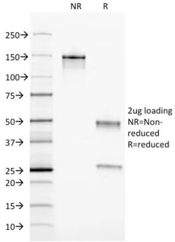 Anti-Ferritin, Light Chain (FTL) (Microglia Marker) (FTL/1389) - image 4