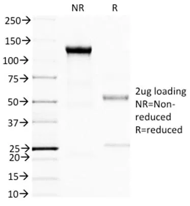 Anti-BRCA1 (Breast Marker) (BRCA1/1398) - image 2